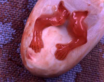 Aborted 7 weeks B
